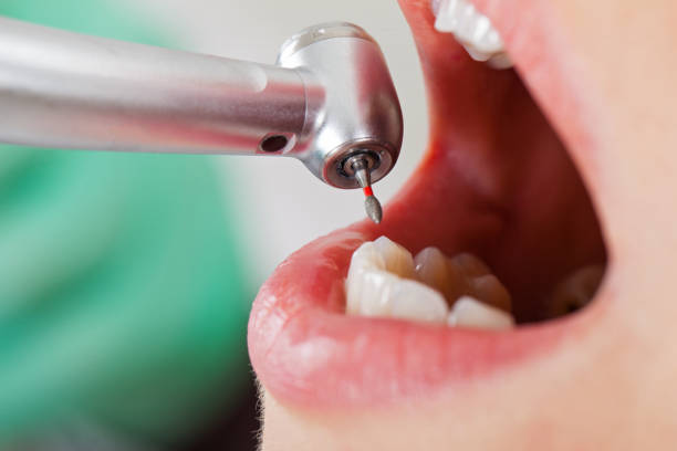 Best Mobile Emergency Dentist in Kendall, FL